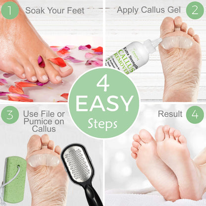 Dr. Entre'S Callus Remover for Feet: Callus Remover Gel, Foot Callus Remover, Pedicure Kit Tools Supplies, Spa Kit, Dead Skin Scrubber,