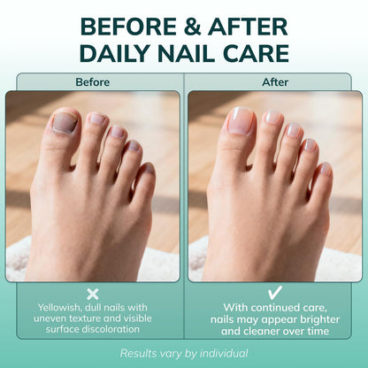 Klearnail Toenail Stick | Medi-Care Treatment | Natural Solution for Healthy Nails I Suitable for Foot, Toe, and Fingernail I for Brittle Toenails – 10Ml / 0.3 Fl. Oz. Pack 1 - Made in USA